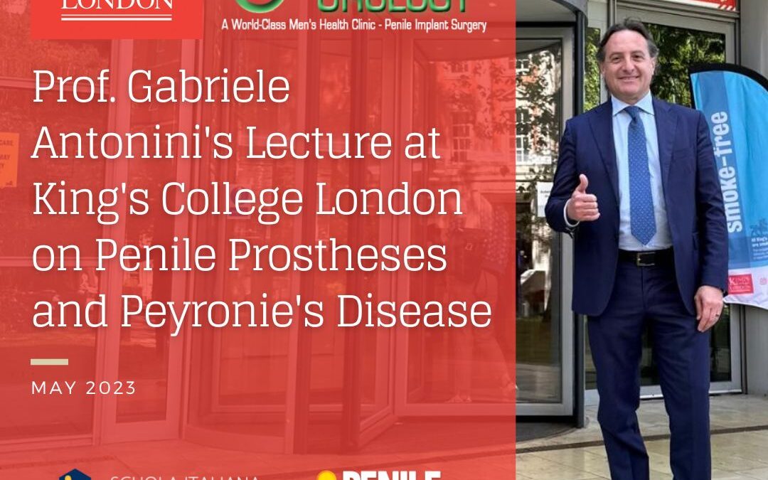Lecture at King’s College London