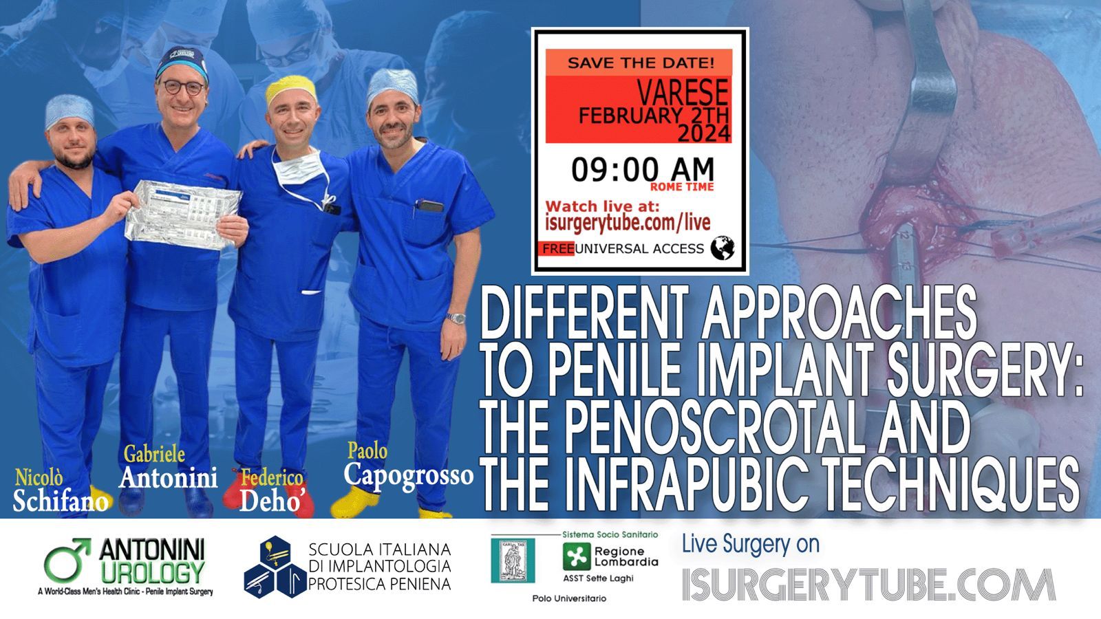 Infrapubic and Penoscrotal Techniques: Dehò and Antonini Together in Varese